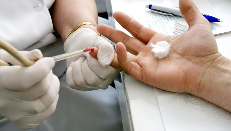 Estado de São Paulo tem tratamento inédito para prevenção do HIV